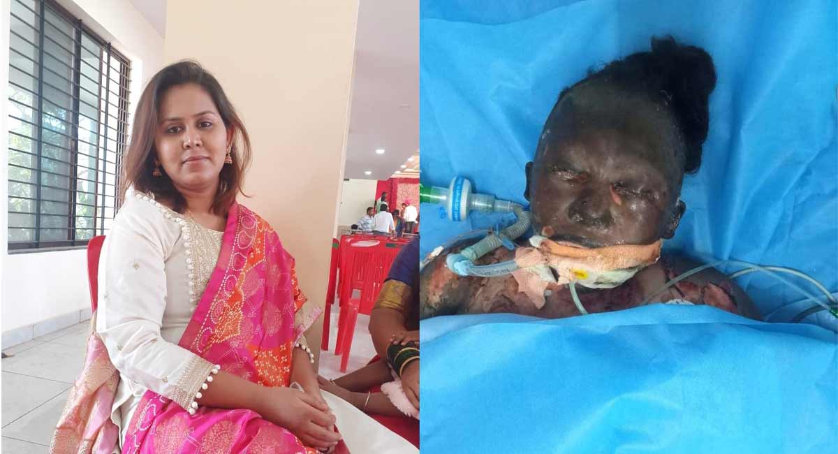 Man torches Dalit partner to death in Bengaluru