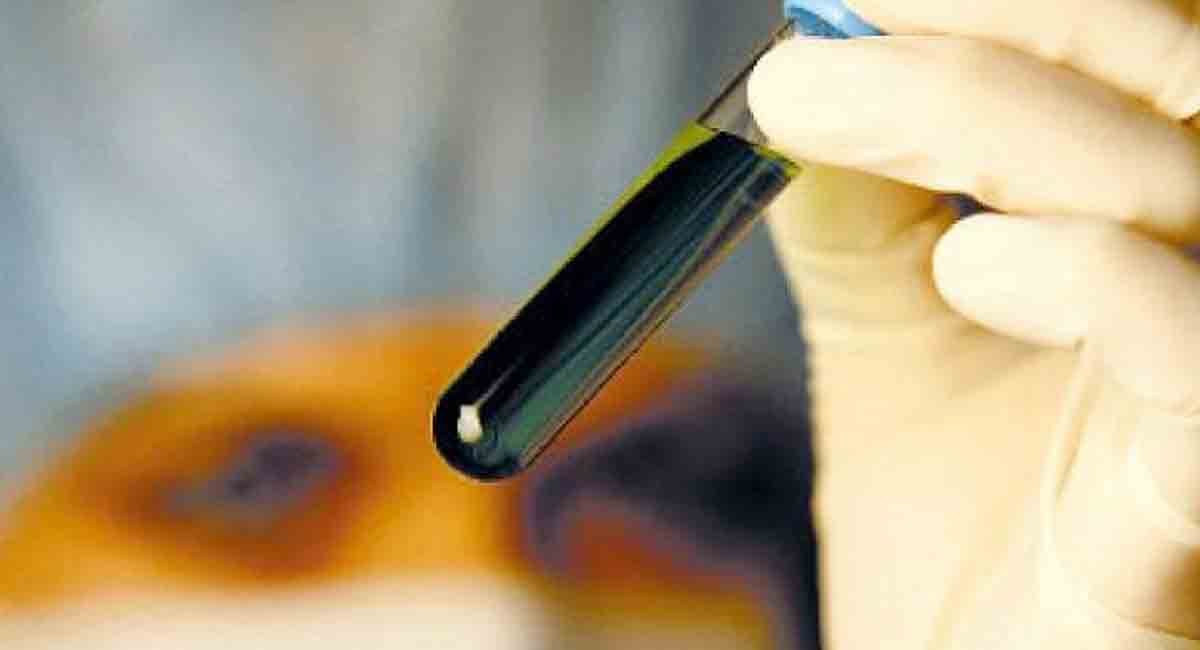 US working with Ukraine to produce biological weapons: Russia