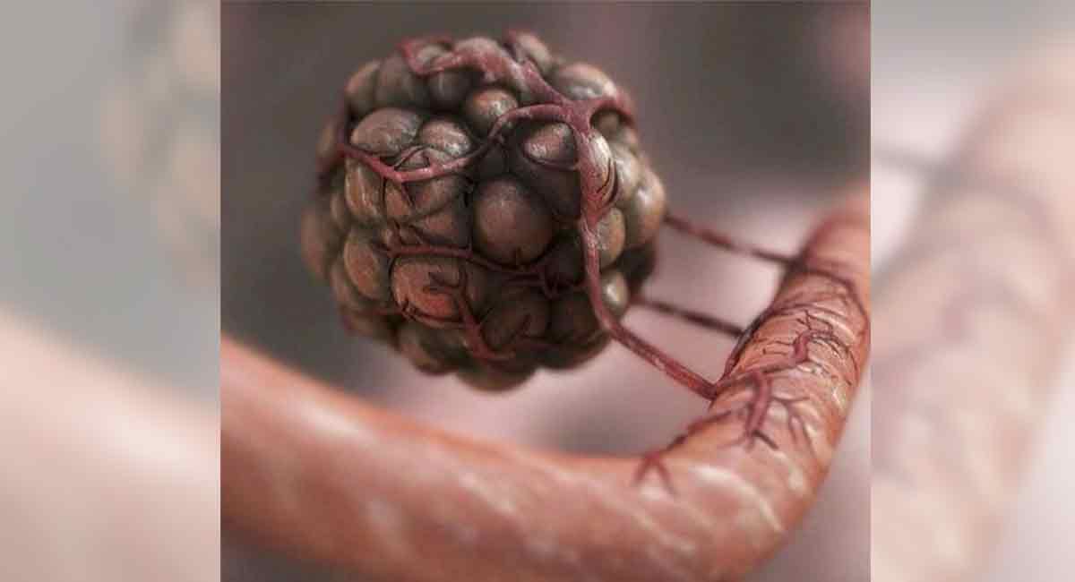 3rd Covid vax may improve immune response in blood cancer patients