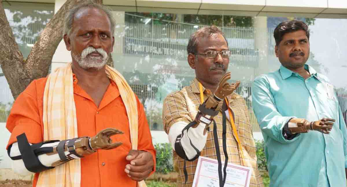 Hyderabad: Rotary District distributes prosthetic hands to needy