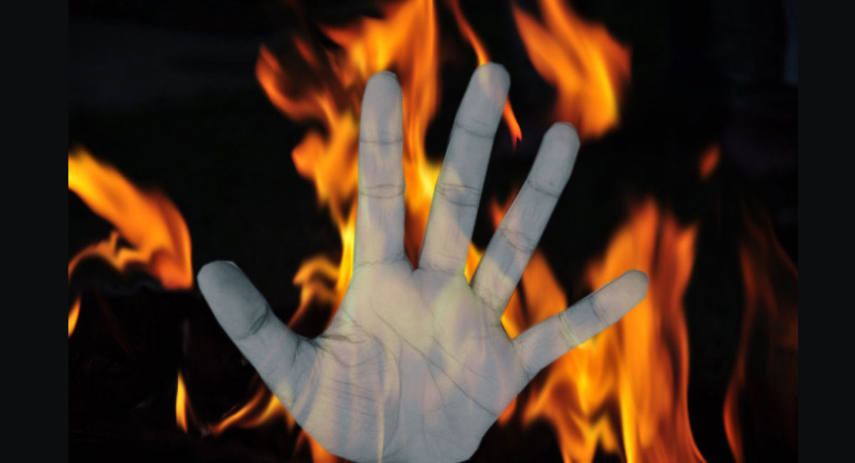 Hyderabad: Man set ablaze by friends in critical condition