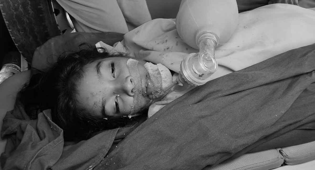 Telangana: 12-year-old student jumps off school building, suffers serious injuries