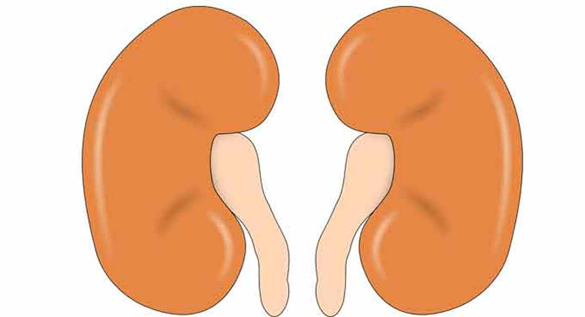 Kidney disease patients are at increased risk of cancer