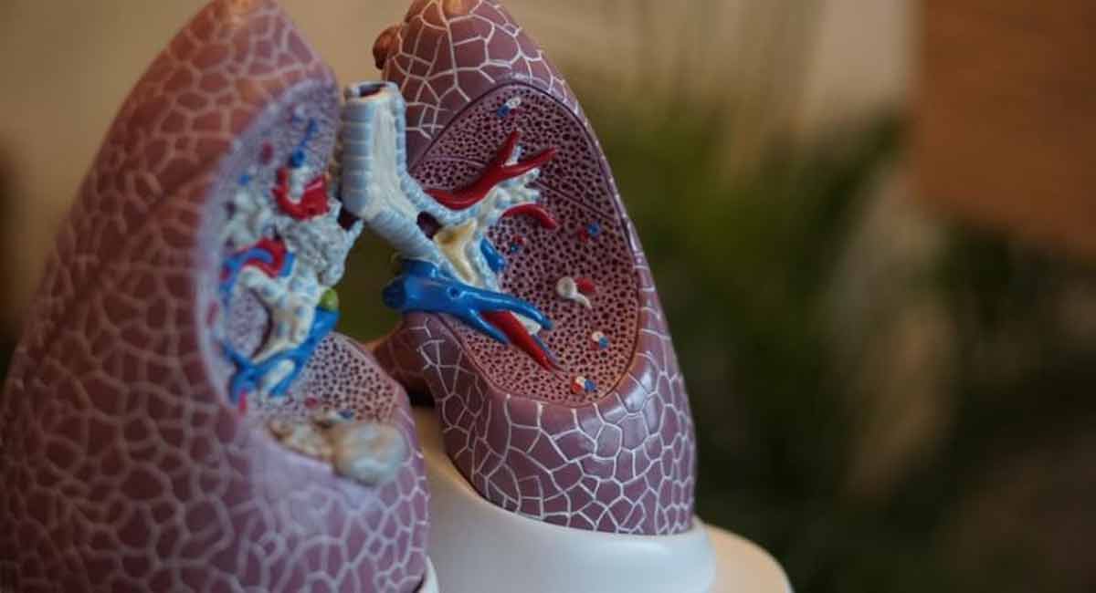 Study finds why people with lung disease are more susceptible to Covid