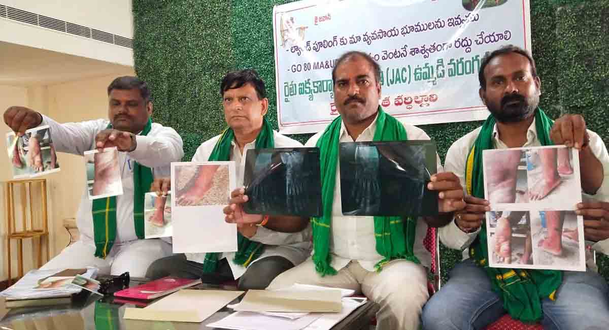 Will not tolerate police torture anymore: Farmers JAC