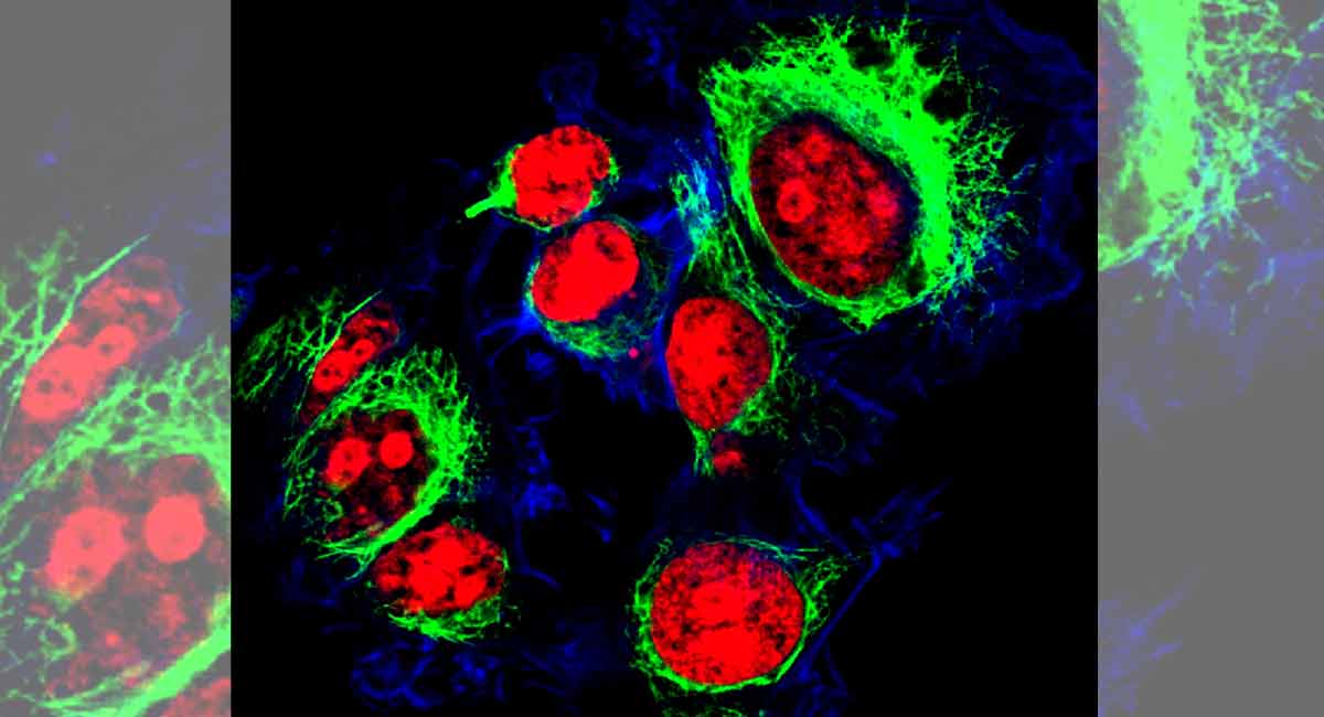 What are HeLa cells?