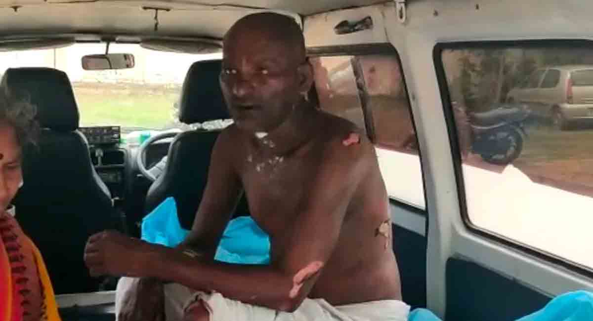 Telangana: Man set ablaze over suspicion of practicing sorcery