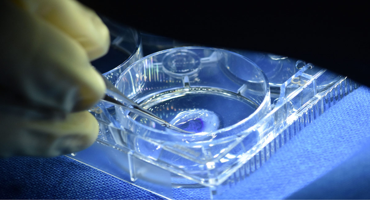 Hyderabad researchers develop India’s first 3D-printed artificial cornea
