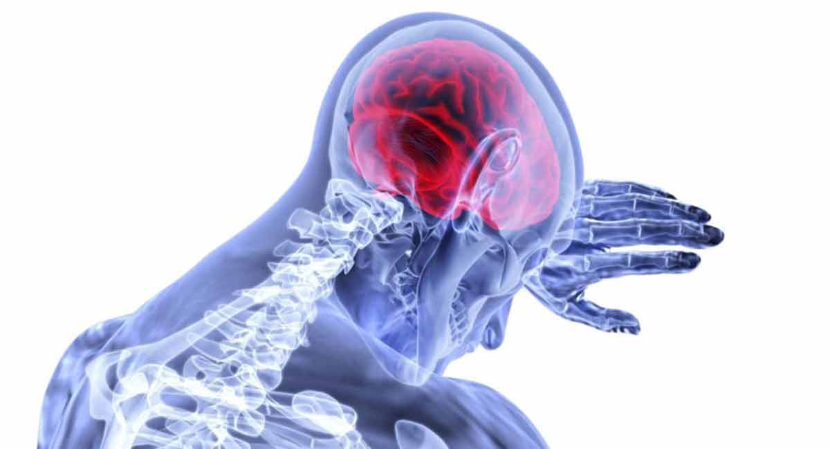 This blood biomarker may up your risk of Alzheimer’s by 35 times