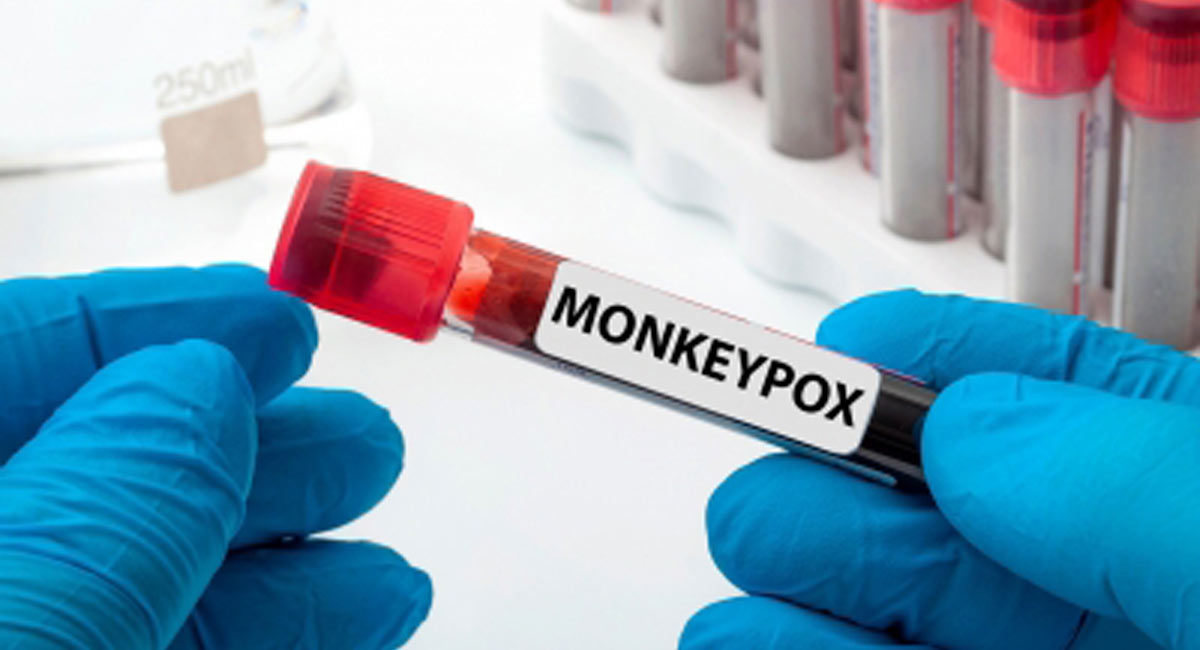 Are kids, pregnant women more at risk for monkeypox?