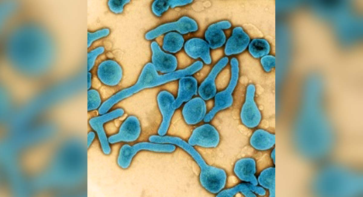 Ghana records one recovered case of Marburg virus disease