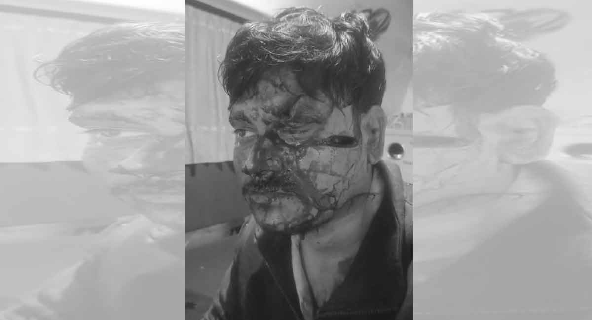 Man attacks son in Sanagreddy with sickle