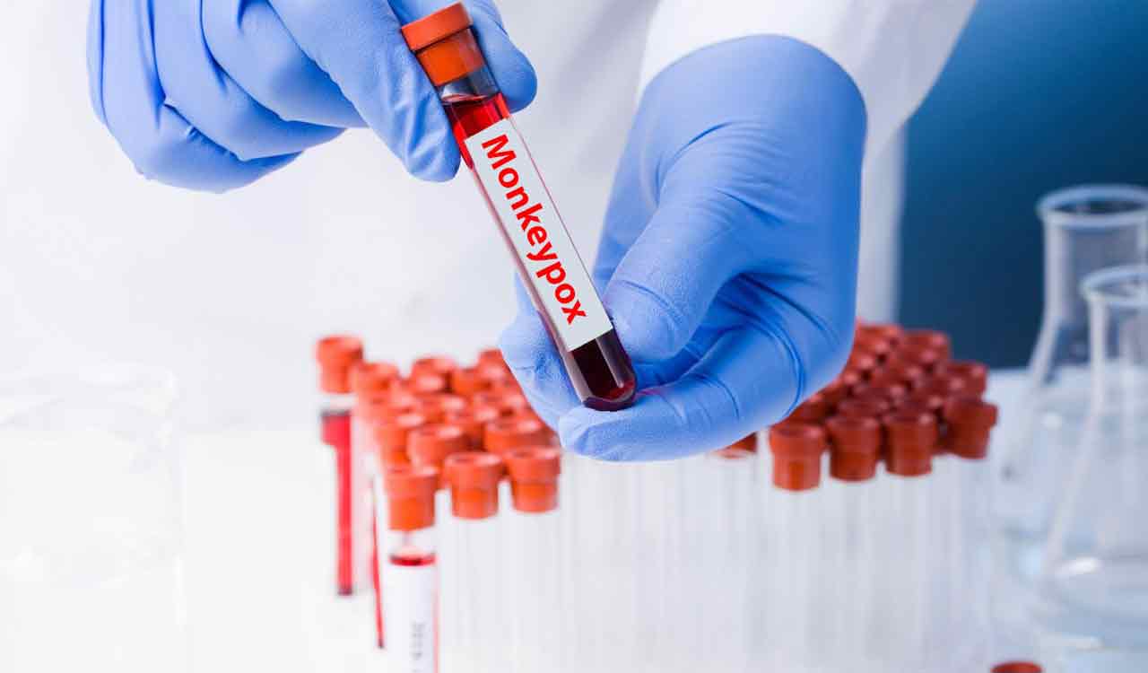 Sewage surveillance system to help track monkeypox, dengue in Hyderabad