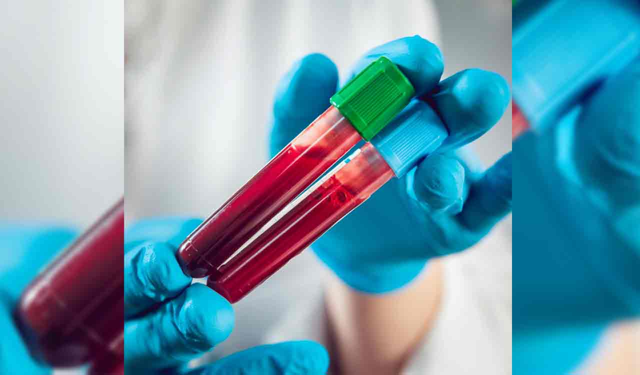 Simple blood test with AI help can predict who will get long Covid