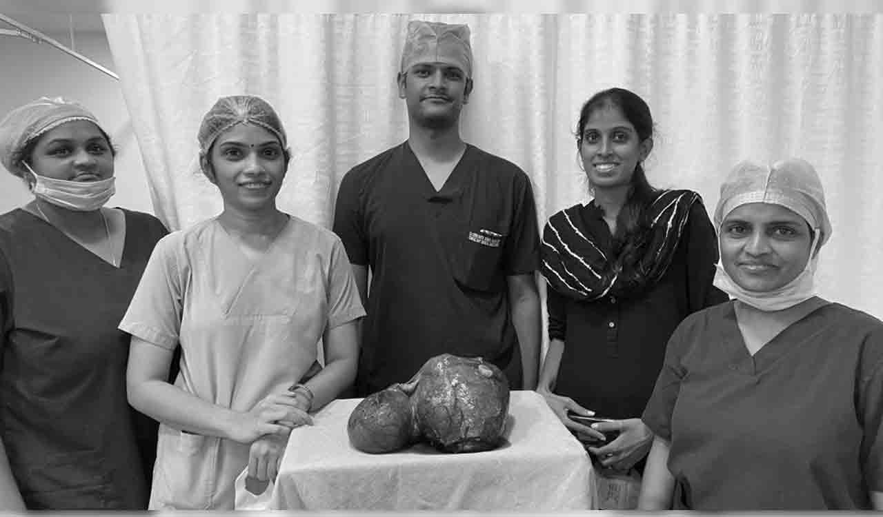 6 kg fibroid mass removed from 50-year-old in Hyderabad