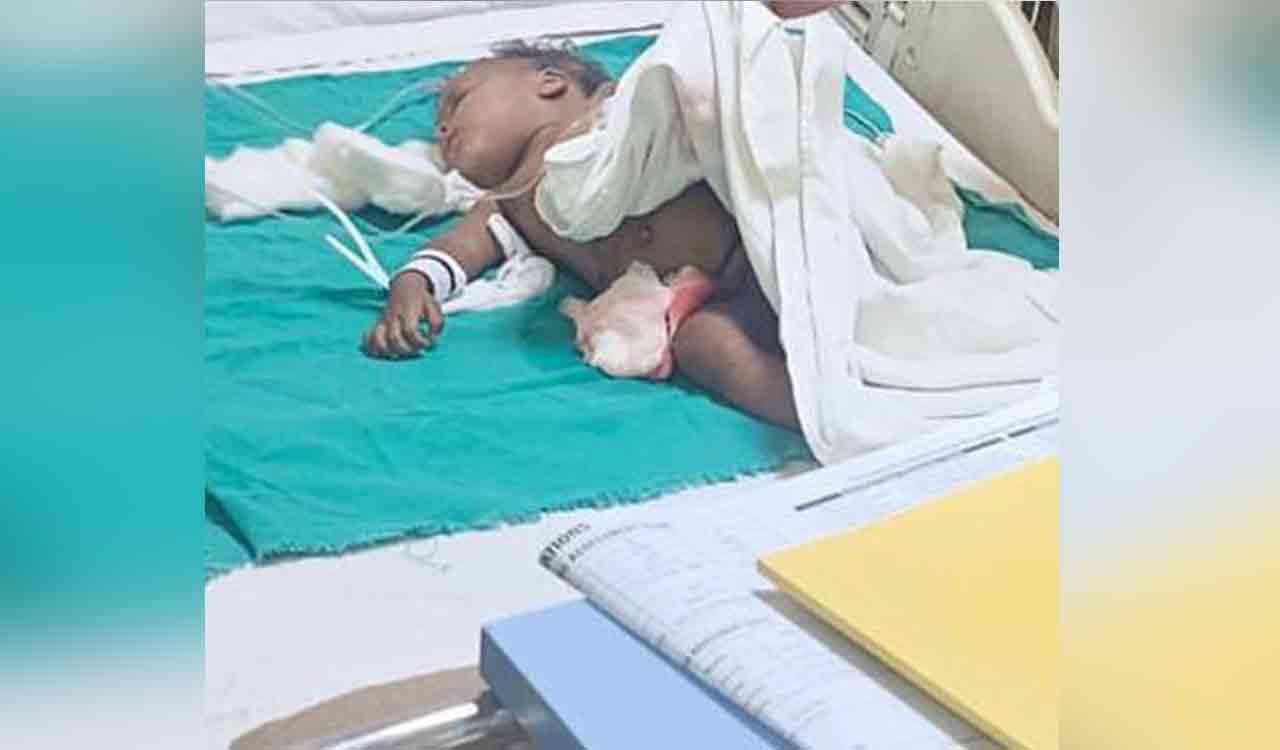 Toddler dies after being attacked by stray dogs in Noida