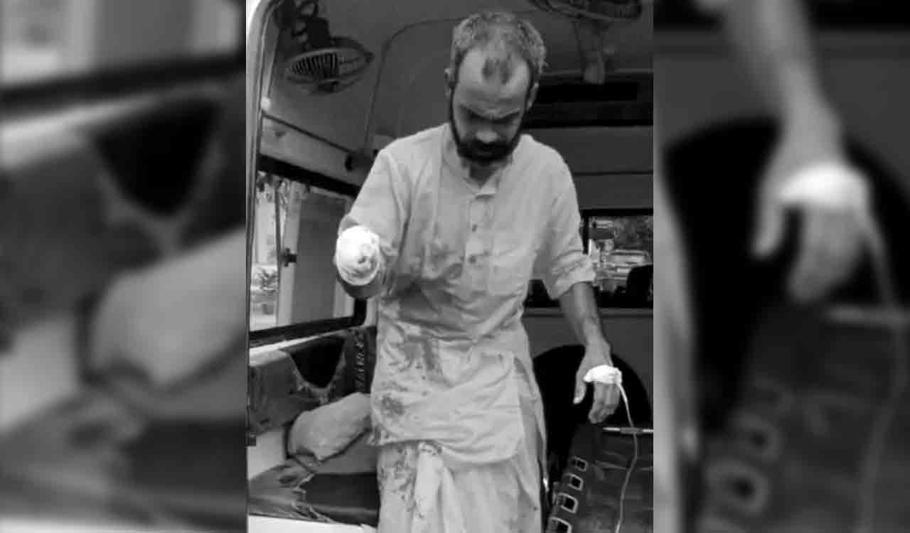 Seer chops off palm as offering in Ayodhya