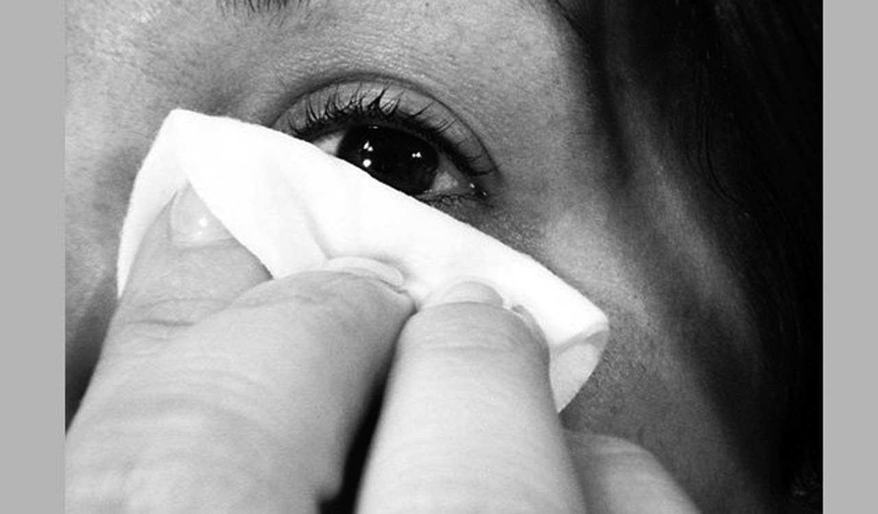 Five home remedies to treat dark circles