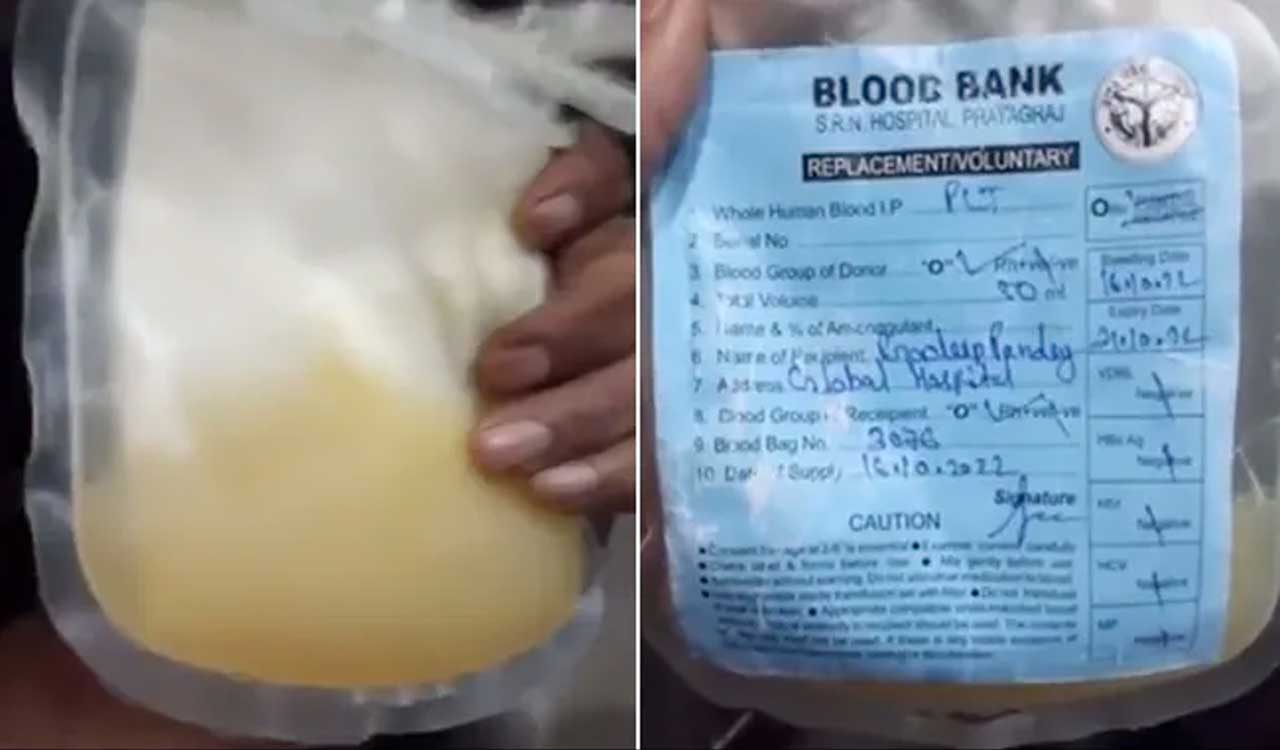 Dengue patient dies after allegedly being transfused Mosambi juice instead of platelets in UP