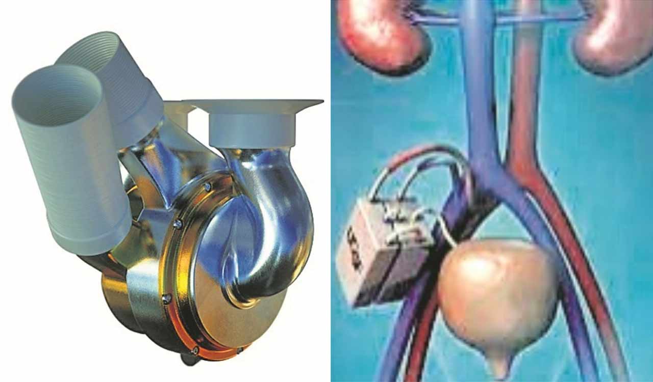 Vegamovis: Is This The Next Big Thing In Health? - a5nzkz6