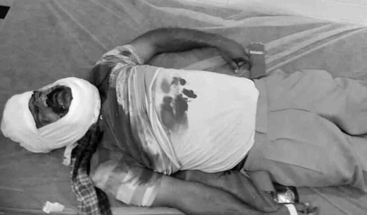 Telangana: FRO killing casts shadow over Podu land surveys