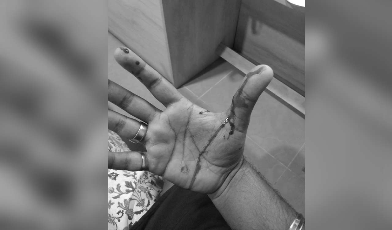 Karnataka man says wife beats him, complains to PM’s office