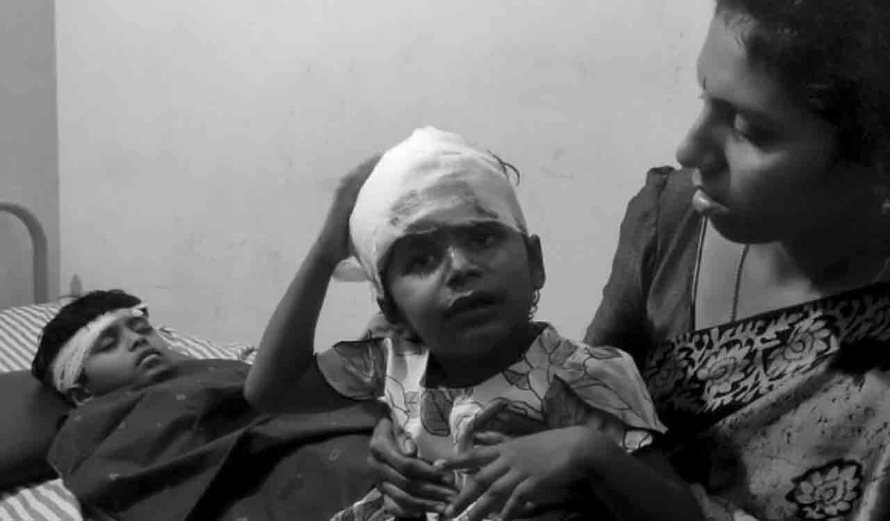 Four children injured after reckless driving by auto driver in Gajwel