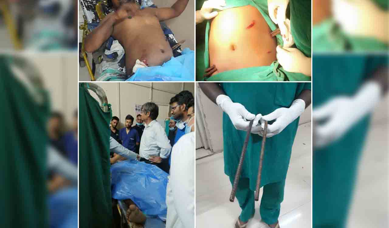 OGH doctors save construction worker impaled by iron rods