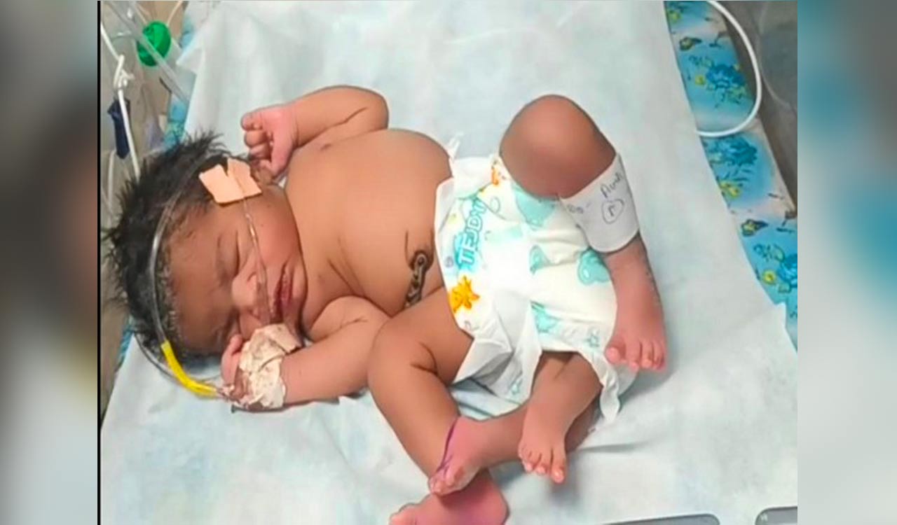 Woman gives birth to baby girl with ‘four’ legs in MP’s Gwalior