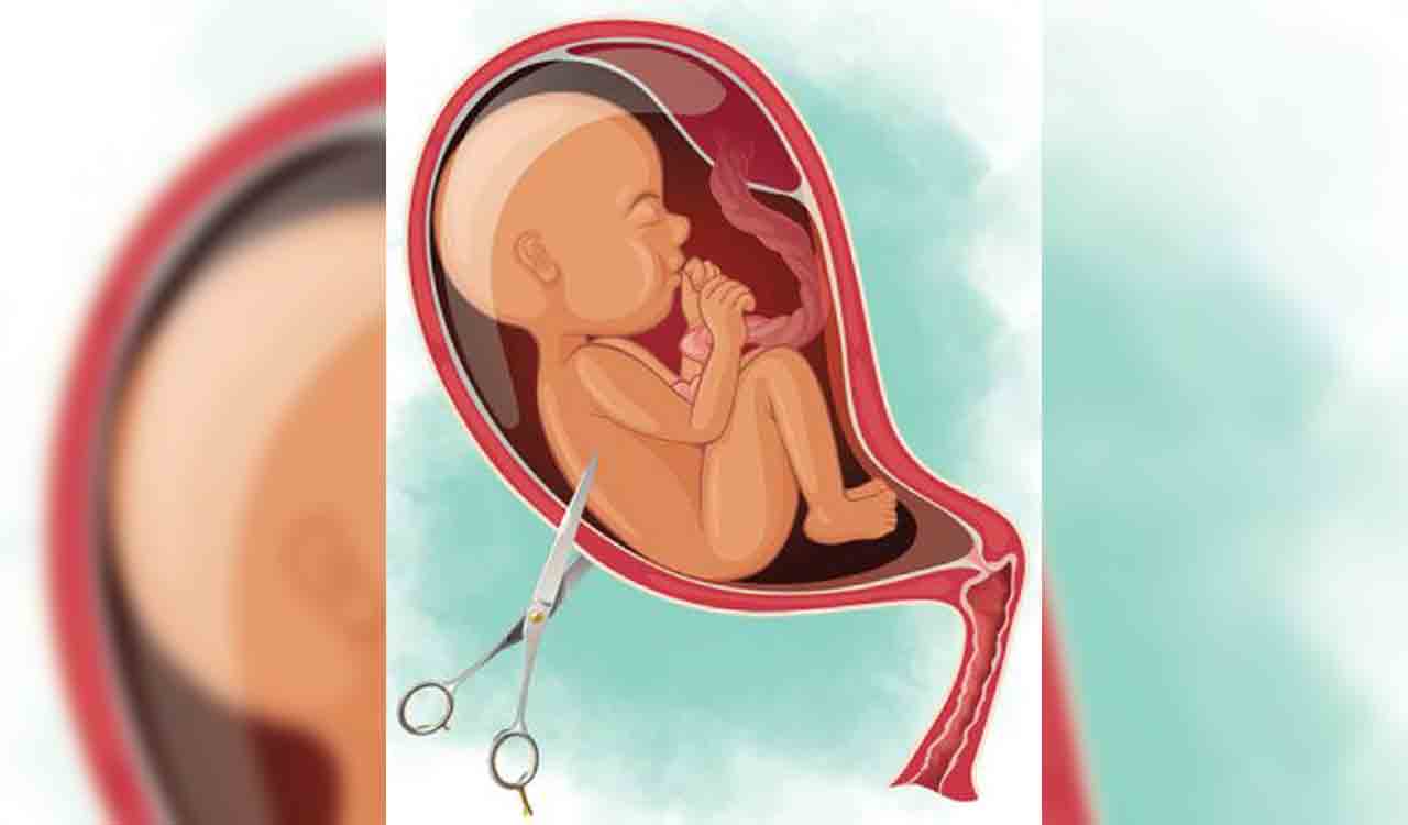 Sex determination, illegal abortions go unchecked in erstwhile Warangal