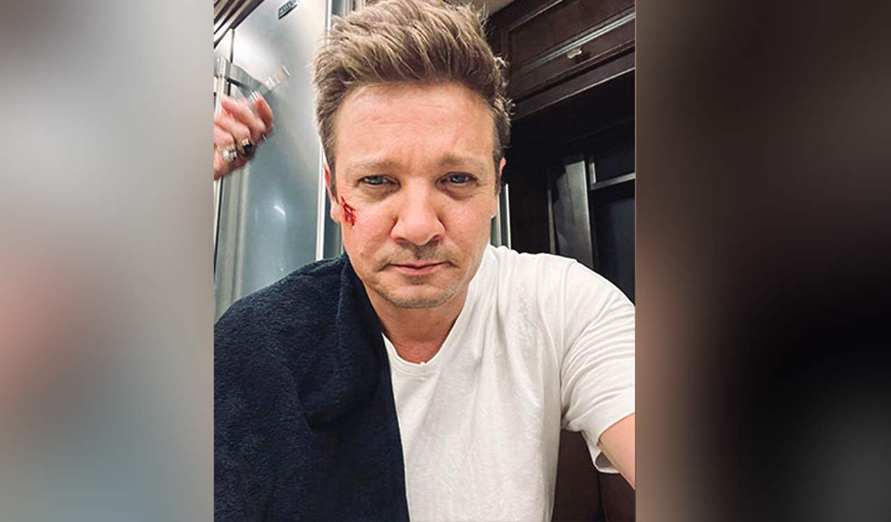 Jeremy Renner reveals he broke over 30 bones in snow plow accident