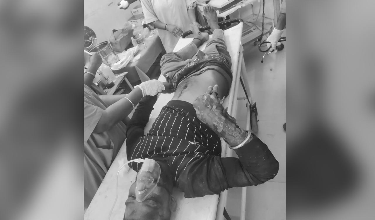 Medak: Man climbs electric pole to taunt cops, electrocuted