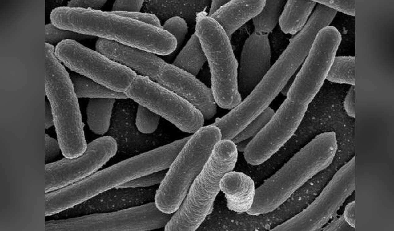 Study finds food coloring nanoparticles can affect human gut