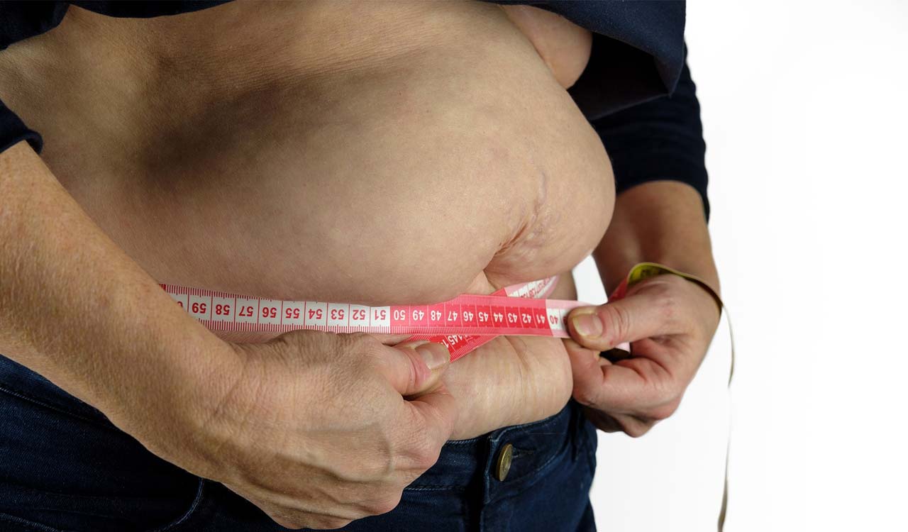 Obesity along with Diabetes: A Lethal Combination