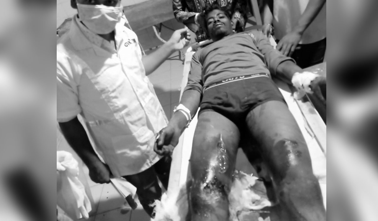 Telangana: Man injured in wild boar attack at Sangareddy