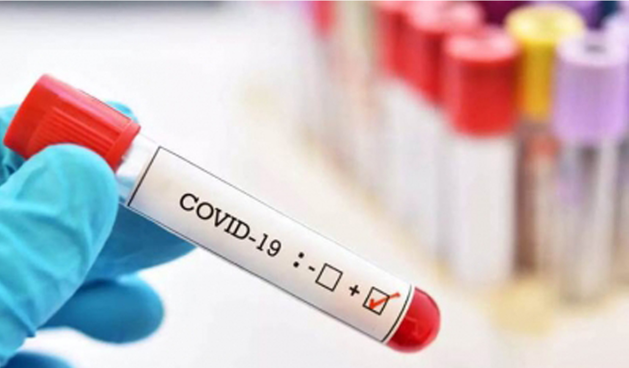 Covid-19 pandemic a result of lab leak: US agency