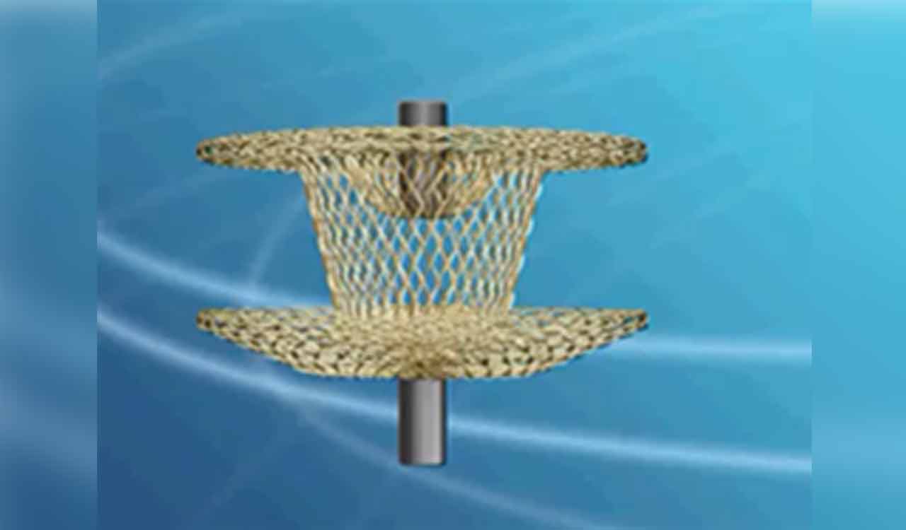 Hyderabad doctor’s medical device gets Indian patent