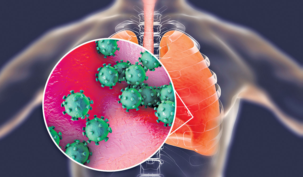 Health and Tech: Surge in seasonal flu detected to H3N2 virus