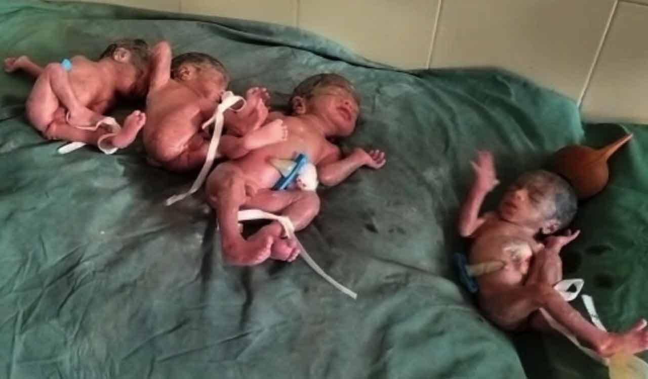 Telangana: Woman gives birth to quadruplets in Sircilla