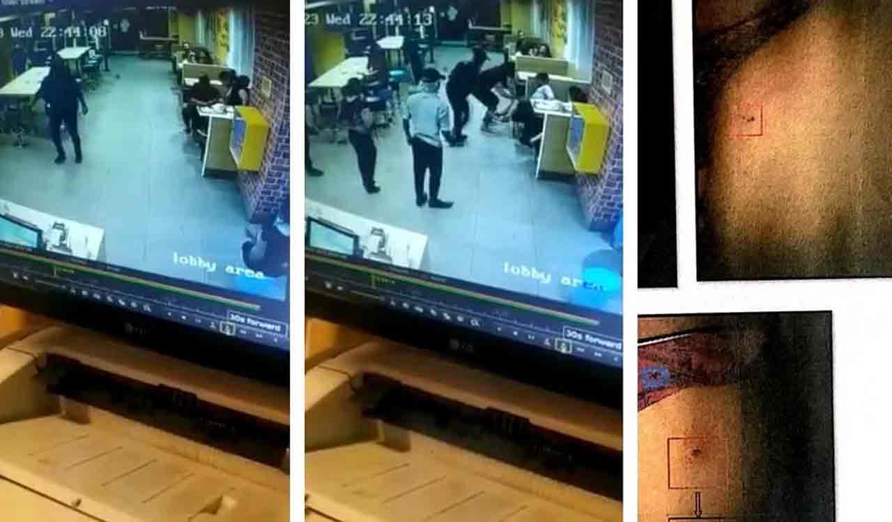 Rat bites 8-year-old boy at fast food major’s outlet in Hyderabad