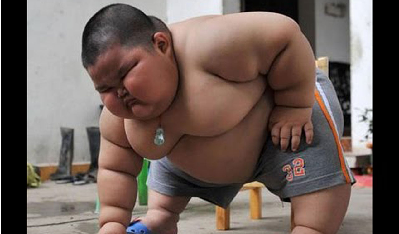 Unregulated consumption of junk sees a rise in childhood obesity