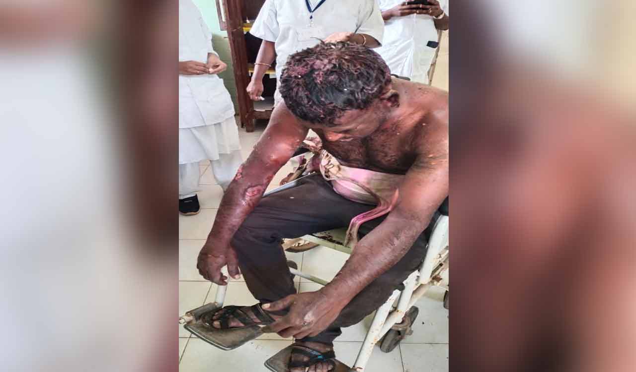 Holi celebrations turn sour as man sets another on fire in Medak