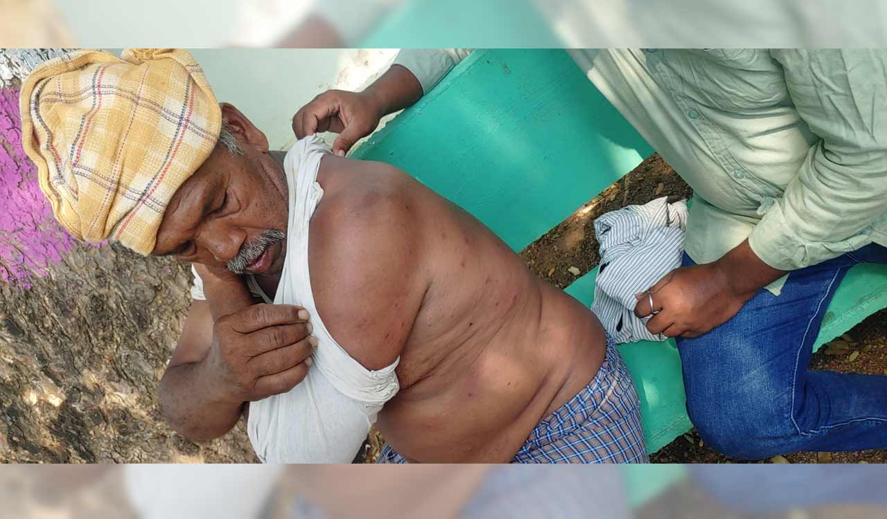 50 NREGA labourers injured in bee attack in Jagtial