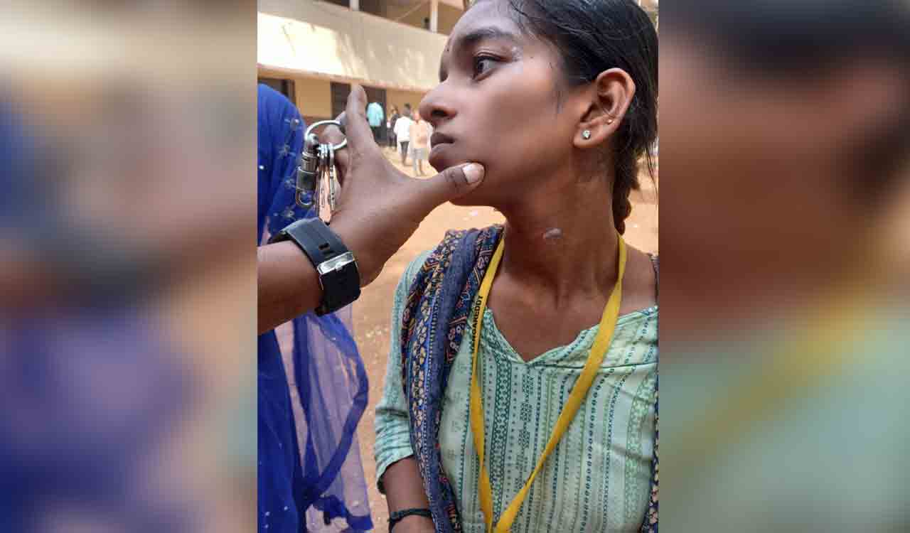 Proposal rejected, youngster attacks girl with razor in Sangareddy
