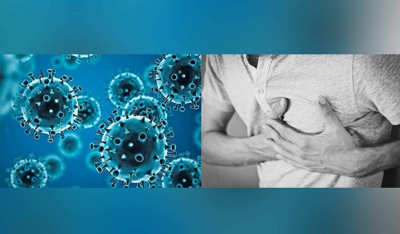 Study finds increased clotting in heart attack patients with Covid-19