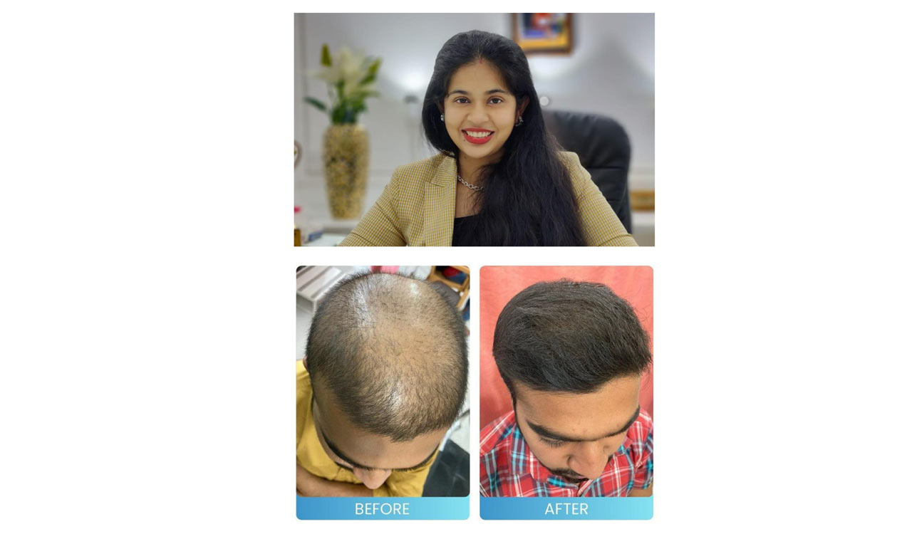 Meet India’s hair growth queen