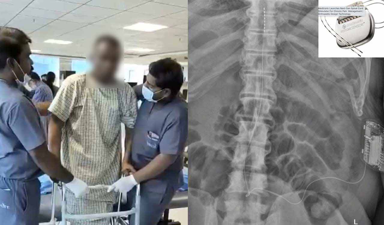 Device implanted near spinal cord of an African national to make him walk
