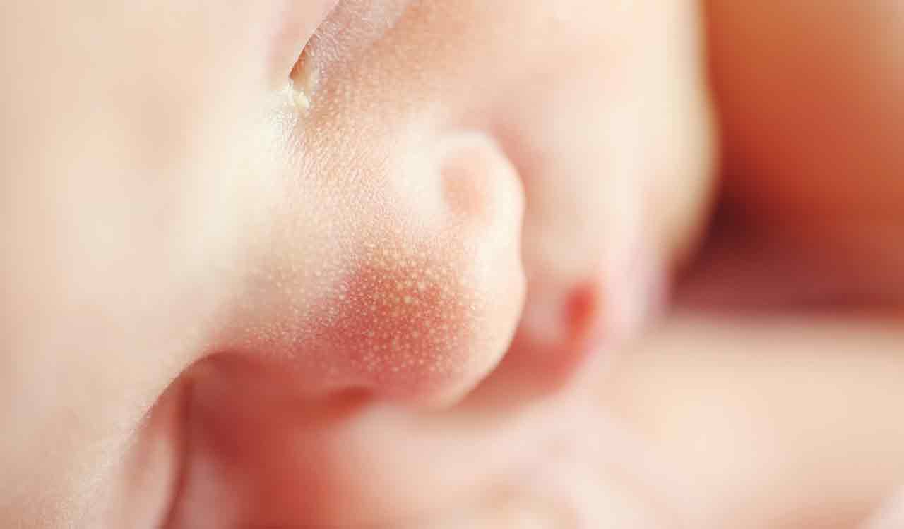 Goa: Infant dies due to asphyxia