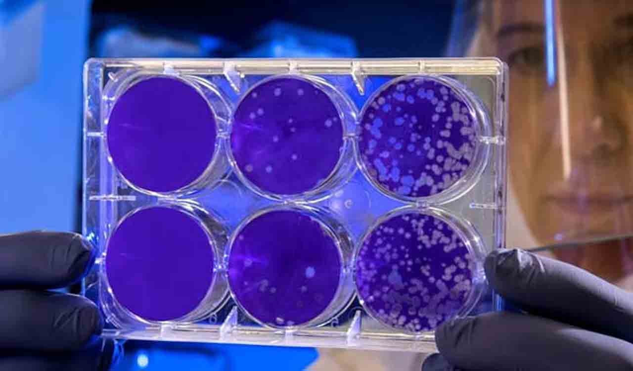 Study reveals probiotics’ role in slowing age-related cognitive decline