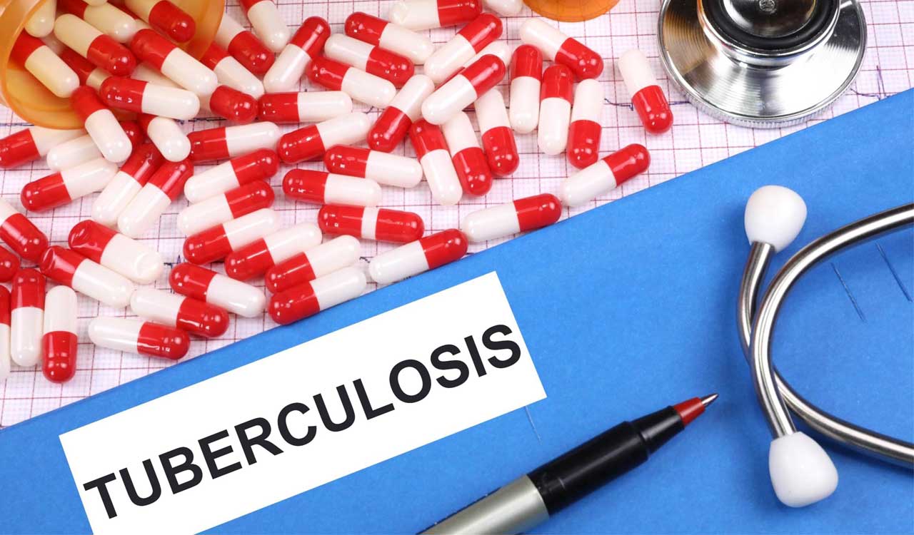 Tuberculosis on the rise for first time in decades after COVID-19 interrupted public health interventions and increased inequality